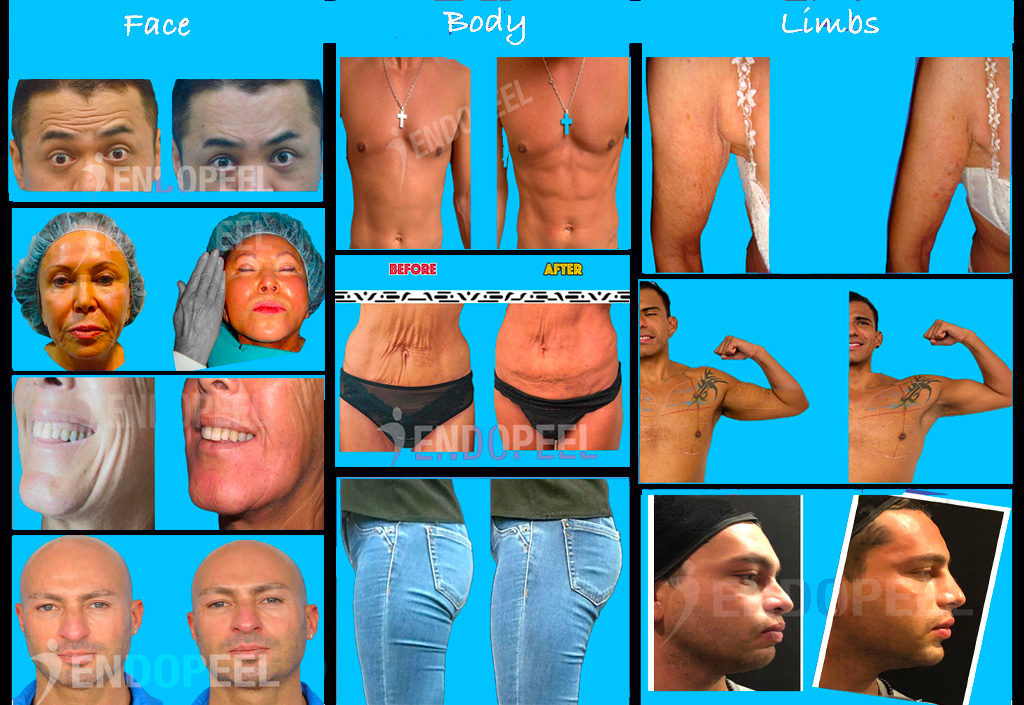 Interactive clinical atlas of Myomodulation® aesthetic indications