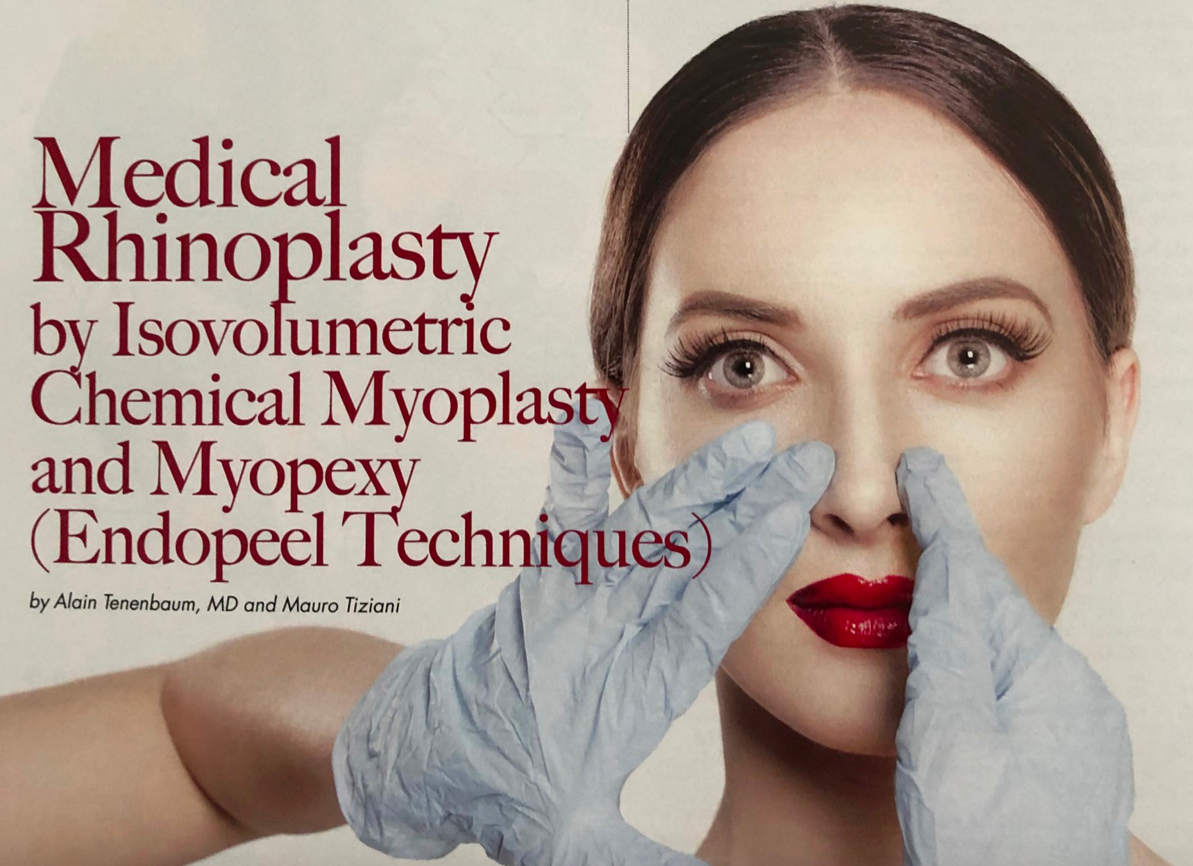 Medical Rhinoplasty with Endopeel